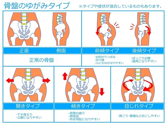 足立区綾瀬の骨盤矯正・産後骨盤矯正で腰痛・体型改善 あやせ駅前